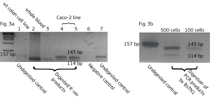 Screening of colon carcinoma lines for the presence of mutation in 12h codone of K-ras oncogene by PCR using primers that introduce BsTN1 restriction enzyme sites into PCR products.