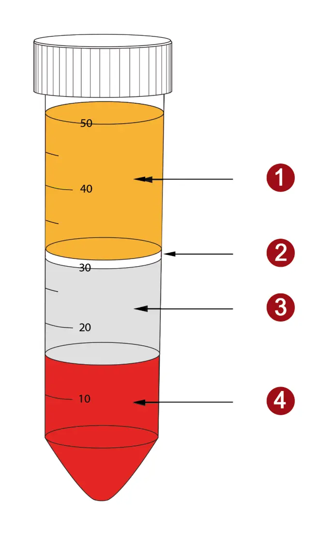 Verteilung der Schichten nach der Dichtegadientenzentrifugation Verteilung der Schichten nach der Dichtegradientenzentrifugation. PBMC (2) sind auf dem Dichtemedium (3) angereichert. Erythrozyten, Granulozyten und tote Zellen passieren das Medium und befinden sich am Boden des Röhrchens (4).